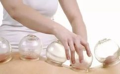 Cupping Therapy for the Back: Methods of Retention, Flash, and Sliding Cupping!