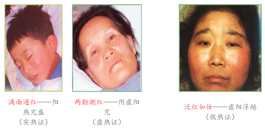 Diagnosis in Traditional Chinese Medicine