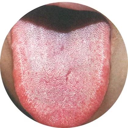 High-Definition Color Atlas of Tongue Diagnosis: Over 100 Types, The Most Comprehensive Ever! (Recommended for Collection)