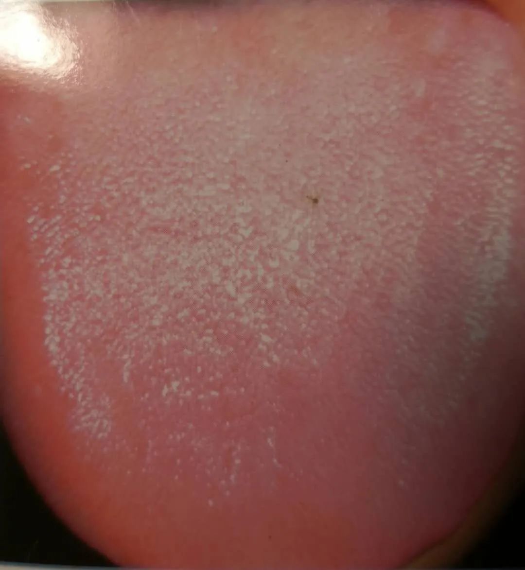 Inheritance of Traditional Chinese Medicine at Zhigu Tang | Basic Theory of TCM Lesson 34 (Tongue Diagnosis: Tongue Color)
