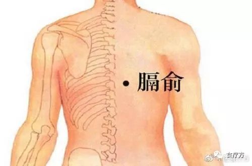 Comprehensive Guide to Cupping Therapy for the Back