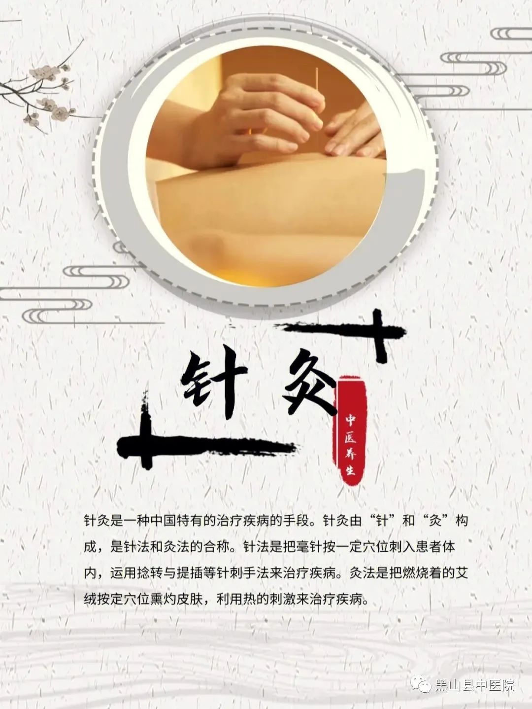Traditional Chinese Medicine - Acupuncture