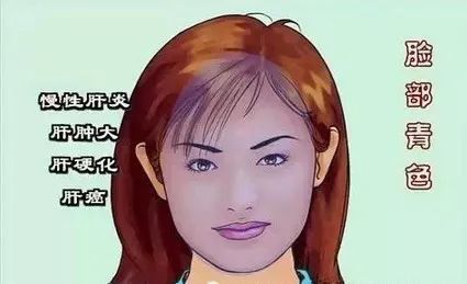 Comprehensive Guide to Facial Diagnosis in Traditional Chinese Medicine (With Images and Explanations)