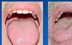 Tongue Diagnosis - Illustrated Guide to Tongue Manifestations
