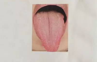 Exploring the Secrets of the Body Through Tongue Diagnosis