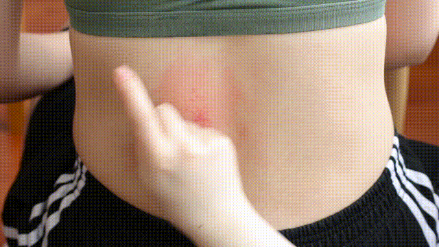 Highly Effective Gua Sha Technique to Remove Chronic Dampness and Toxins from the Body