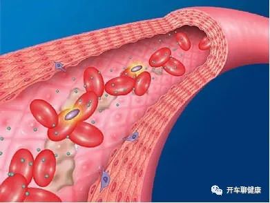 Self-Assessment of Blood Stasis Constitution: Not Only Must Blood Stasis Be Activated and Resolved, But Qi Must Also Be Nourished