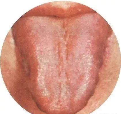 130 High-Definition Tongue Diagnosis Charts (Recommended for Collection)