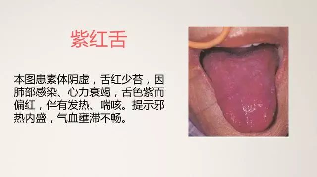 The Most Comprehensive TCM Tongue Diagnosis Atlas: Observe the Tongue, Understand the Whole Body!