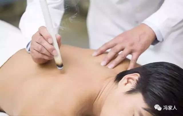 How to Use Moxibustion for Cold Hands and Feet? Three Warming Yang Points