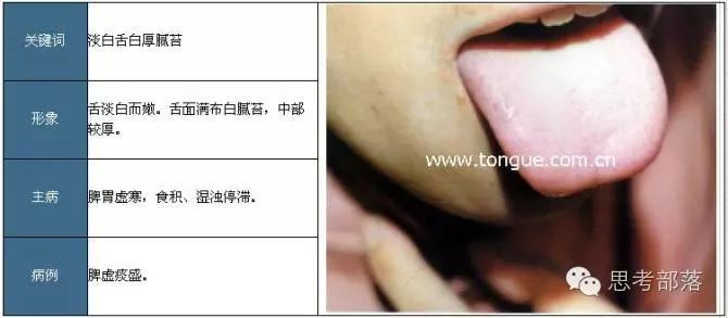 Comprehensive Guide to Tongue Diagnosis (8): 72 Types of Tongue Diagnosis Charts