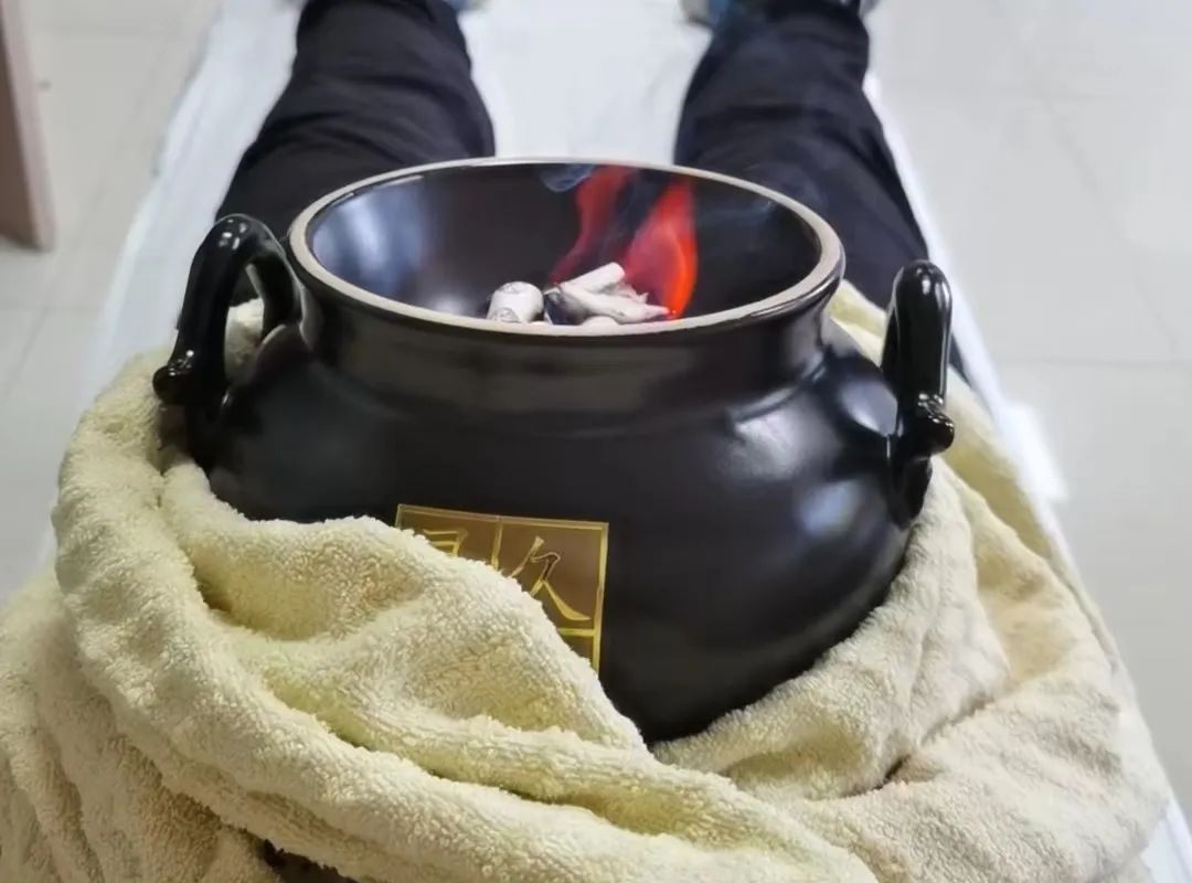 Traditional Chinese Medicine Therapy: Warming Yang Cupping