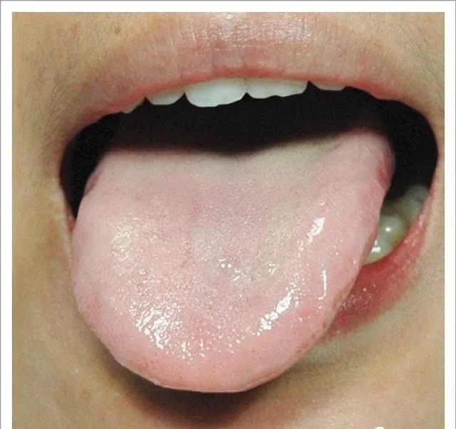 Traditional Chinese Medicine Tongue Diagnosis: 26 Clinical High-Definition Tongue Diagnosis Images with Analysis