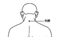Ten Gua Sha Techniques to Relieve Various Ailments