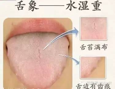 Comprehensive Guide to Tongue Diagnosis (Tongue Manifestations)