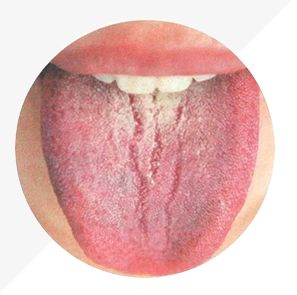 Analysis of High-Definition Tongue Diagnosis Charts: Understanding Health Through Your Tongue (Part 1)