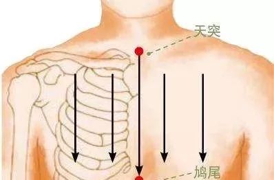 Key Techniques for Gua Sha