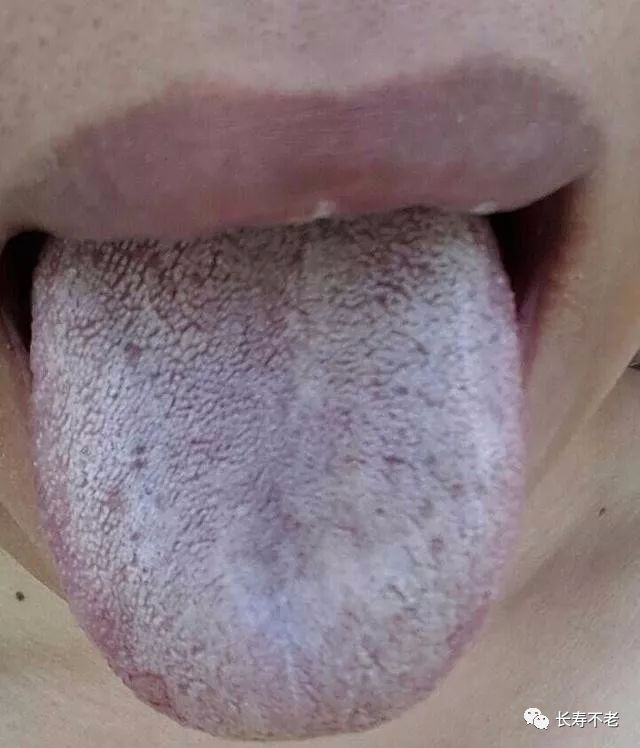 The Most Comprehensive TCM Tongue Diagnosis Atlas: Observe the Tongue, Understand the Whole Body!