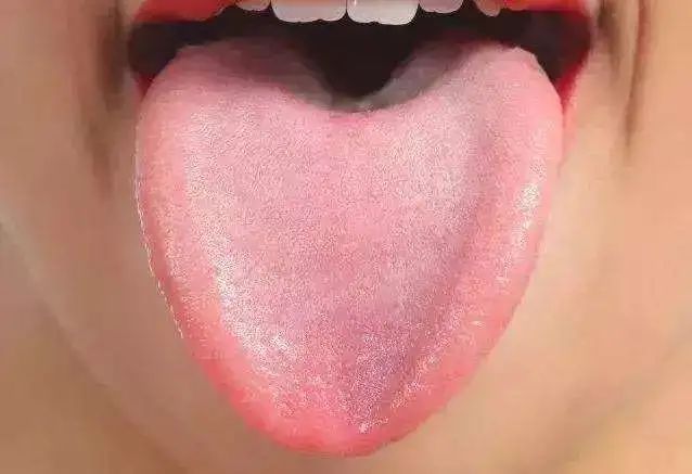 Traditional Chinese Medicine Tongue Diagnosis (Part Four) — Content of Tongue Diagnosis and Normal Tongue Appearance