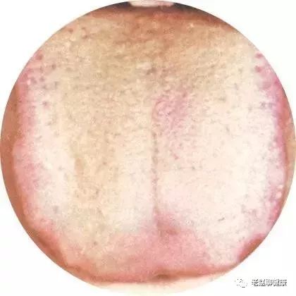 Learn Quick Ways to Observe Tongue Quality and Coating to Understand Your Health and Diseases!