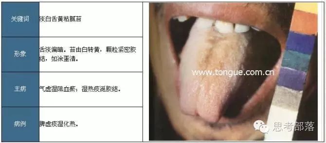 Comprehensive Guide to Tongue Diagnosis (8): 72 Types of Tongue Diagnosis Charts