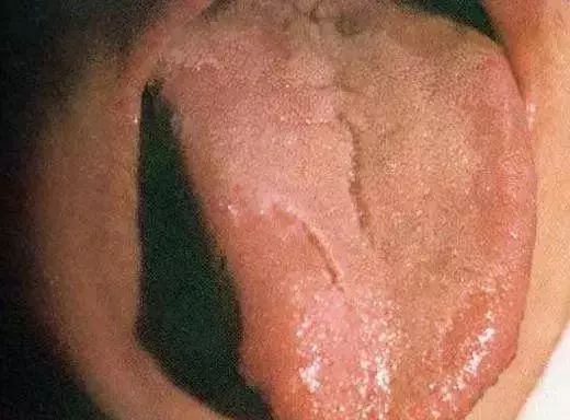 The Most Comprehensive Guide to Tongue Diagnosis! Master It and Become a Tongue Diagnosis Expert