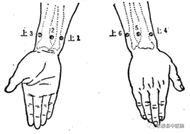 Traditional Chinese Medicine Techniques: Acupuncture Techniques
