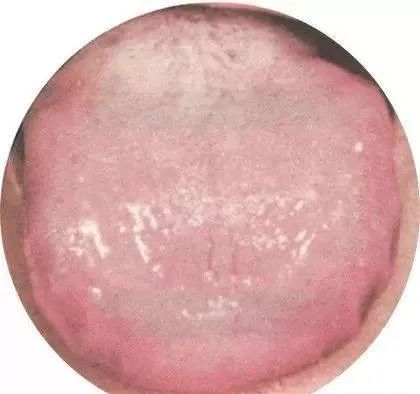130 High-Definition Tongue Diagnosis Charts (Recommended for Collection)
