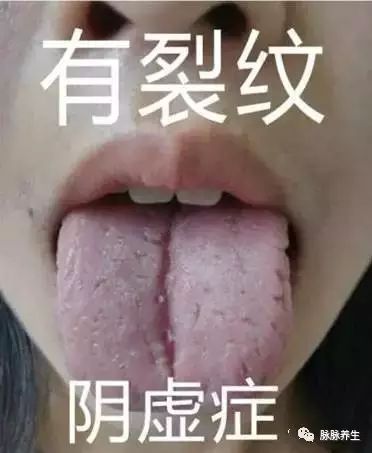 Tongue Diagnosis: A Clear Insight