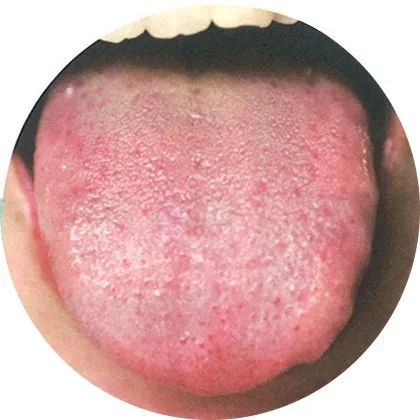 The Most Comprehensive High-Definition Real Tongue Diagnosis: Observing Tongue Patterns to Understand Internal Organs (Collection Edition)