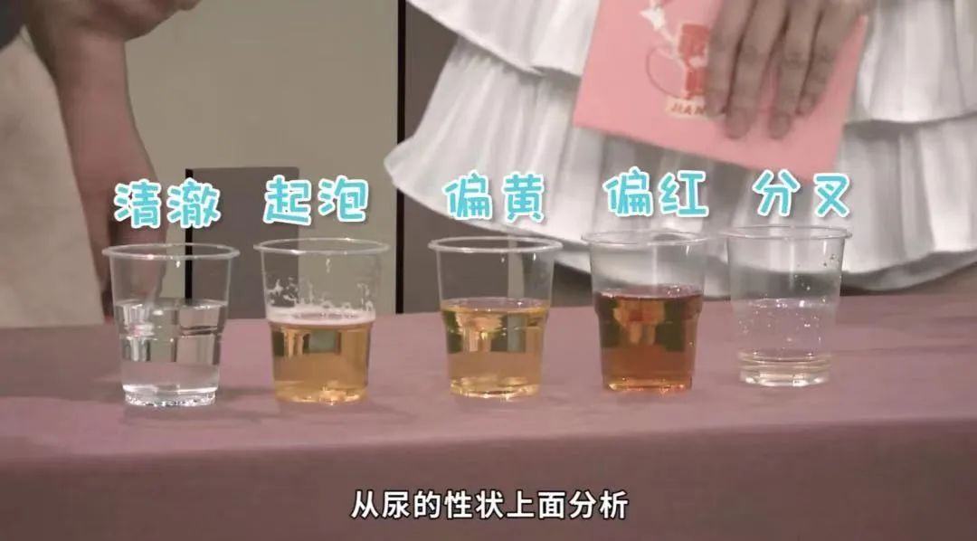 What is 'Dampness' as Commonly Said by People in Guangdong? Recommended TCM Formulas for Dampness Removal