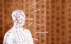 Inheriting Acupuncture Techniques and Promoting Traditional Chinese Medicine Culture