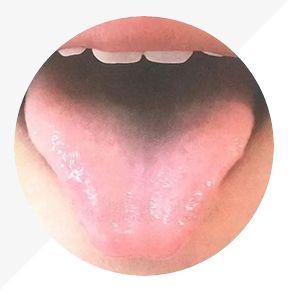 Analysis of High-Definition Tongue Diagnosis Charts: Understanding Health Through Your Tongue (Part 1)