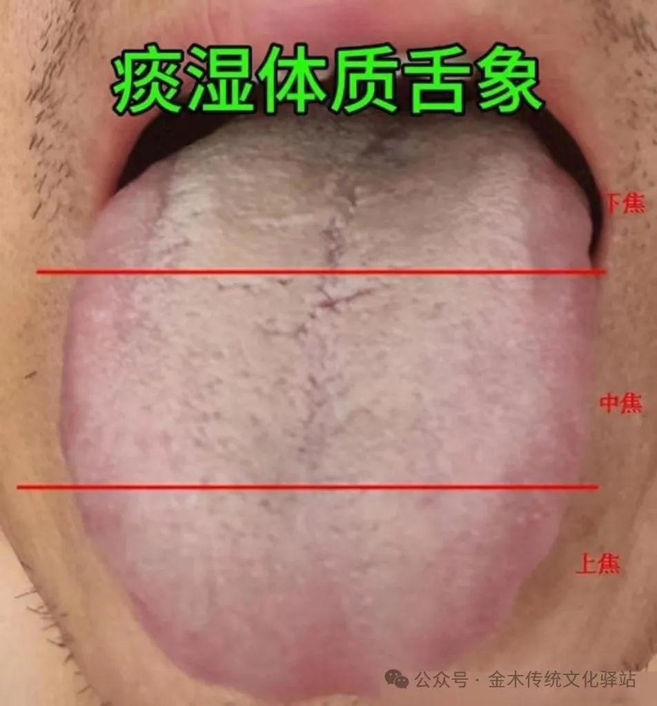 The Harm of Phlegm-Dampness to the Human Body