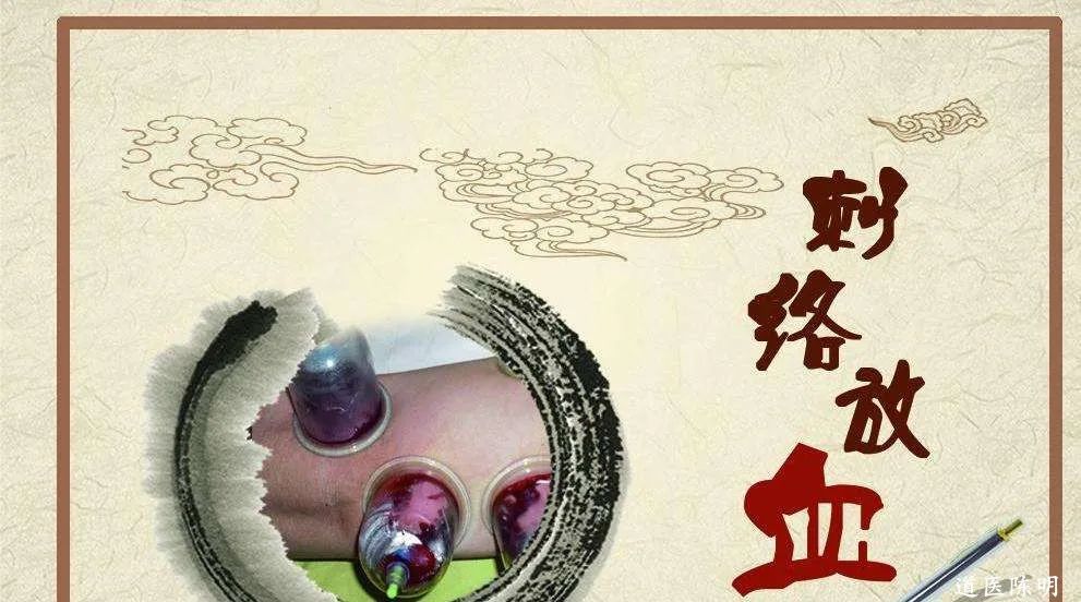 Bloodletting Therapy in Traditional Chinese Medicine: A Pathway to Healing