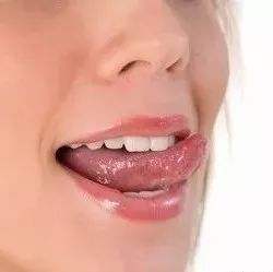 Understanding Health Through Tongue Diagnosis in Traditional Chinese Medicine