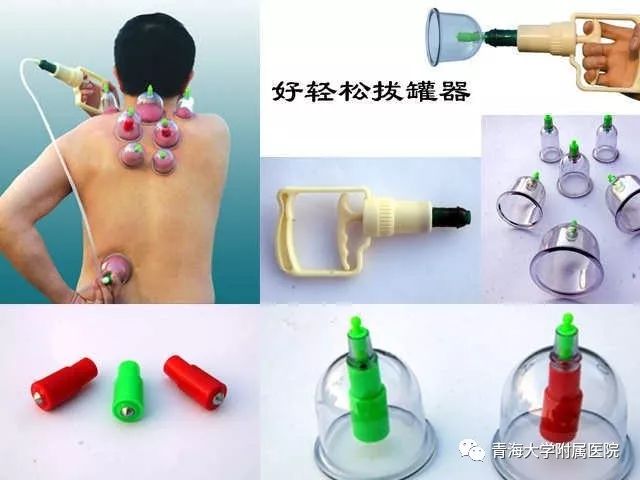 Understanding the Technique of Pricking and Cupping Therapy