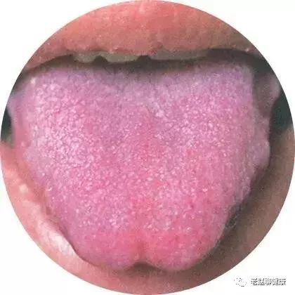 Learn Quick Ways to Observe Tongue Quality and Coating to Understand Your Health and Diseases!