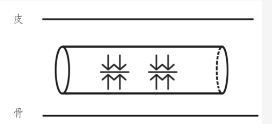 Understanding the Xian Pulse in Traditional Chinese Medicine