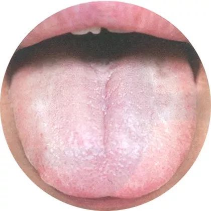 Comprehensive Tongue Diagnosis Guide
