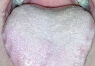 The TCM Tongue Diagnosis Atlas is Here! Observe the Tongue to Understand the Whole Body!