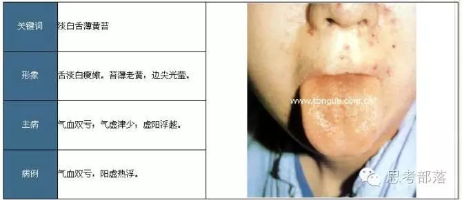 Comprehensive Guide to Tongue Diagnosis (8): 72 Types of Tongue Diagnosis Charts