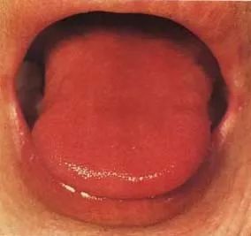 The Health Code Hidden on Your Tongue