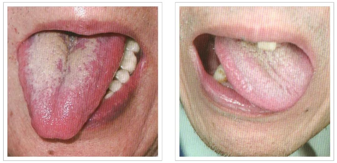 Analysis of Tongue Quality and Movement in Traditional Chinese Medicine
