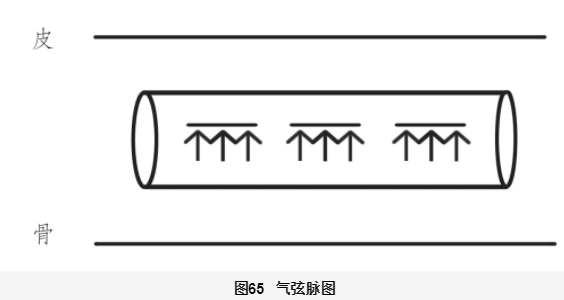 Understanding the Xian Pulse in Traditional Chinese Medicine