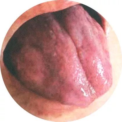 The Most Comprehensive High-Definition Real Tongue Diagnosis: Observing Tongue Patterns to Understand Internal Organs (Collection Edition)