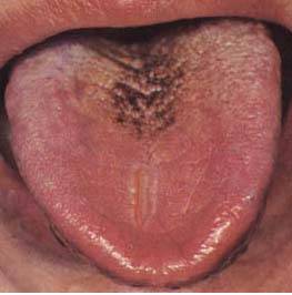 62 High-Definition Tongue Diagnosis Charts with Illustrations (Collector's Edition)
