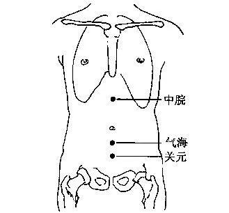 Identifying TCM Constitutions for More Accurate Regulation