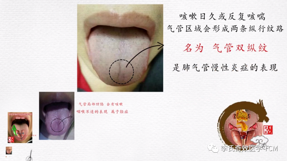 Tongue Diagnosis and the Lungs (Animated Version)