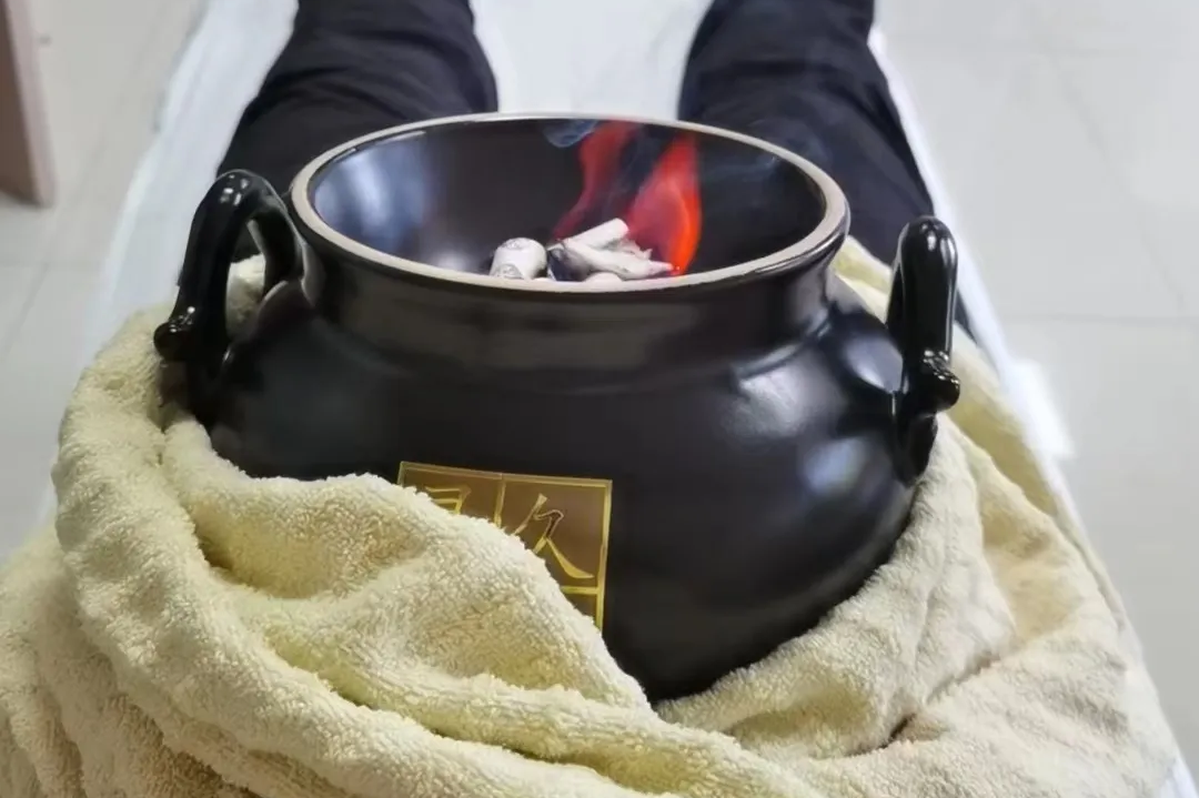 Traditional Chinese Medicine Suitable Techniques - Warming Yang Cupping